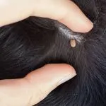 Can Ticks Lay Eggs in Hair?