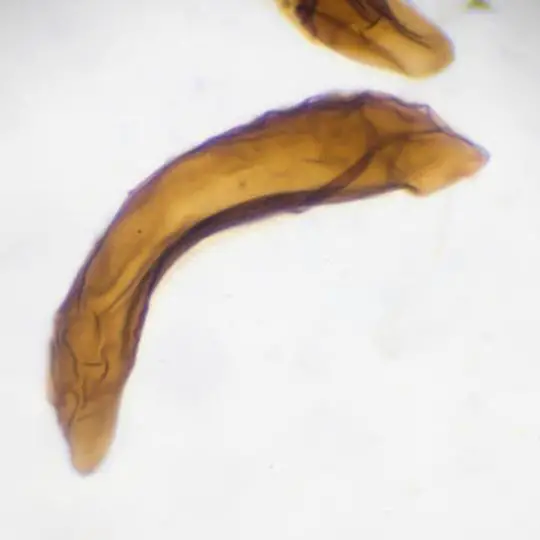 microscopic view of a mosquito pupa